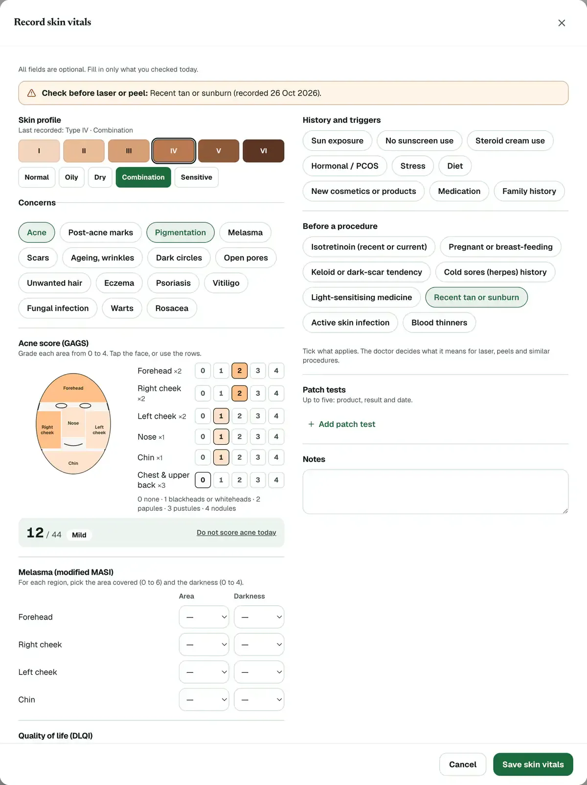 The Record skin vitals form with Fitzpatrick type IV and combination skin picked, acne graded on the face map with its total, and Recent tan ticked under Before a procedure.