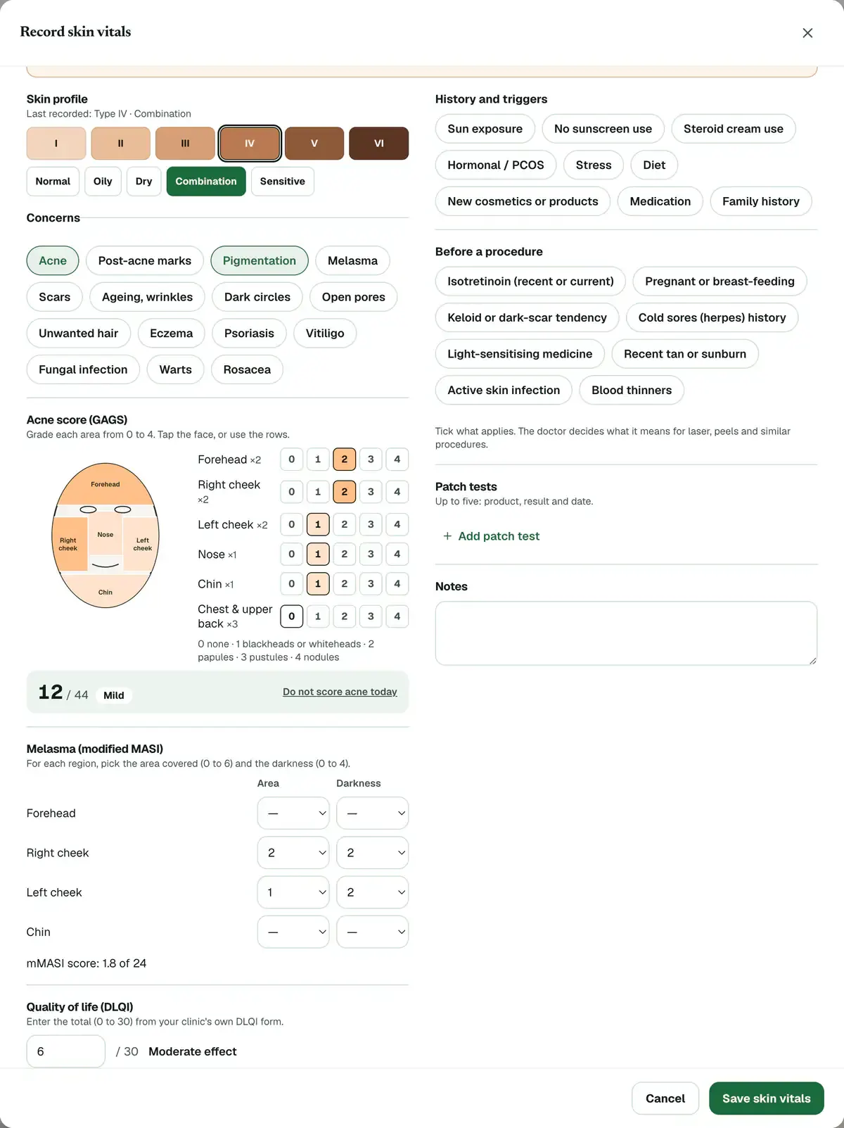 The same form scrolled down to melasma, with the area and darkness chosen for both cheeks, the mMASI score under them, and a DLQI total with its meaning.
